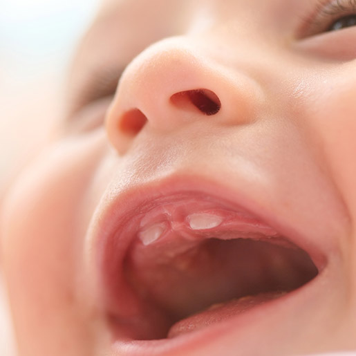Zahndurchbruch baby bilder